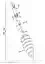 Fig. 84 - MEDICAL DEVICE AND PROCEDURE FOR ATTACHING TISSUE TO BONE