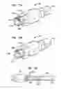 Fig. 87 - MEDICAL DEVICE AND PROCEDURE FOR ATTACHING TISSUE TO BONE