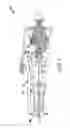 Fig. 08 - BODY-POSITIONING AID FOR BODY ALIGNMENT