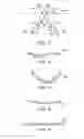 Fig. 44 - Stabilization system and method