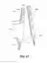 Fig. 58 - Stabilization system and method