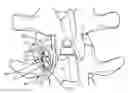 Fig. 01 - Vertebral implant