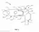 Fig. 03 - Vertebral implant
