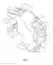 Fig. 04 - Vertebral implant