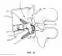 Fig. 16 - Vertebral implant