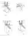 Fig. 02 - Bone screw