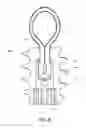 Fig. 06 - Swivel Screw Ligament Fixation Device