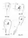 Fig. 07 - Swivel Screw Ligament Fixation Device