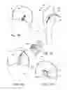 Fig. 08 - Swivel Screw Ligament Fixation Device