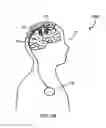 Fig. 03 - Systems and methods for enhancing or affecting neural stimulation efficiency and/or efficacy