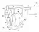 Fig. 01 - Endocardial pacing devices and methods useful for resynchronization and defibrillation