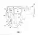 Fig. 02 - Endocardial pacing devices and methods useful for resynchronization and defibrillation