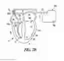 Fig. 06 - Circuit-based devices and methods for pulse control of endocardial pacing in cardiac rhythm management