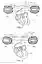 Fig. 02 - Implantable lead connector
