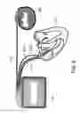 Fig. 06 - Implantable lead connector