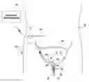 Fig. 01 - Flexible tube sensor for sensing urinary sphincter pressure