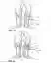 Fig. 08 - Peripheral nerve stimulation