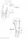 Fig. 10 - Peripheral nerve stimulation