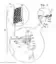 Fig. 02 - Retinal prosthesis