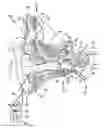 Fig. 01 - WIRELESS REMOTE DEVICE FOR A HEARING PROSTHESIS