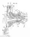Fig. 02 - WIRELESS REMOTE DEVICE FOR A HEARING PROSTHESIS