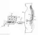 Fig. 01 - NEUROSTIMULATION SYSTEM AND METHOD WITH GRAPHICALLY MANIPULATABLE STIMULATION TARGET