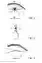 Fig. 04 - System and method for delivering electromagnetic radiation to the eyeball of a subject