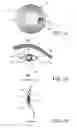 Fig. 06 - System and method for delivering electromagnetic radiation to the eyeball of a subject