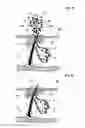 Fig. 05 - Methods for treating skin conditions using laser