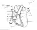 Fig. 01 - Transcoronary sinus pacing system, LV summit pacing, early mitral closure pacing, and methods therefor