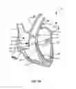 Fig. 02 - Transcoronary sinus pacing system, LV summit pacing, early mitral closure pacing, and methods therefor