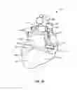 Fig. 05 - Transcoronary sinus pacing system, LV summit pacing, early mitral closure pacing, and methods therefor