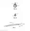 Fig. 07 - Transcoronary sinus pacing system, LV summit pacing, early mitral closure pacing, and methods therefor