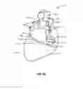 Fig. 14 - Transcoronary sinus pacing system, LV summit pacing, early mitral closure pacing, and methods therefor