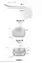 Fig. 02 - COCHLEAR IMPLANT WITH IMPROVED LUMEN ARRANGEMENT