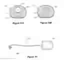Fig. 07 - COCHLEAR IMPLANT WITH IMPROVED LUMEN ARRANGEMENT