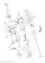 Fig. 02 - Precannulated fenestration