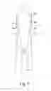 Fig. 10 - Precannulated fenestration