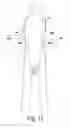 Fig. 12 - Precannulated fenestration