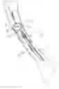 Fig. 05 - Introducer assembly