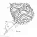 Fig. 10 - Collapsing structure for reducing the diameter of a stent end