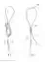 Fig. 12 - Collapsing structure for reducing the diameter of a stent end
