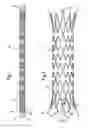 Fig. 02 - Implant with attached element and method of making such an implant