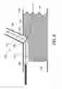 Fig. 10 - STENT GRAFT FENESTRATION