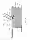 Fig. 11 - STENT GRAFT FENESTRATION