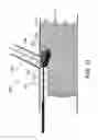 Fig. 12 - STENT GRAFT FENESTRATION