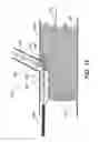 Fig. 13 - STENT GRAFT FENESTRATION