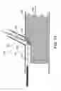 Fig. 14 - STENT GRAFT FENESTRATION