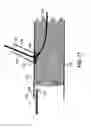 Fig. 18 - STENT GRAFT FENESTRATION