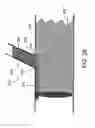 Fig. 30 - STENT GRAFT FENESTRATION